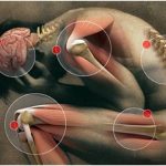 Cannabis and Fibromyalgia